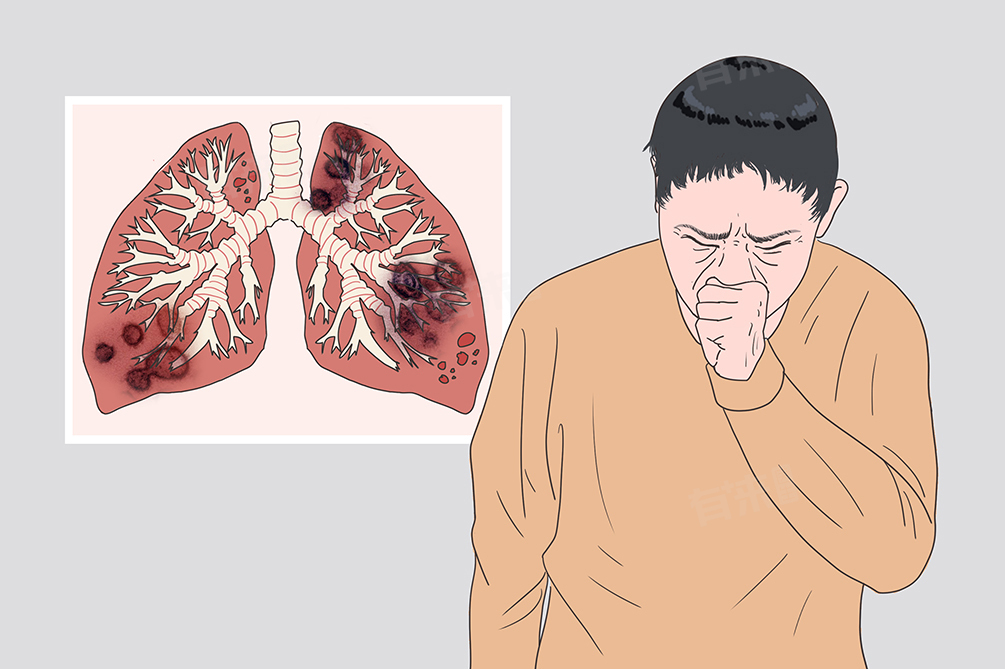 新型冠状病毒感染的传播途径及预防措施，含疫情传播方式介绍